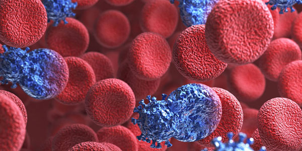 HIV as the Lead Killer